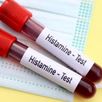 Histamin İntoleransı Testi