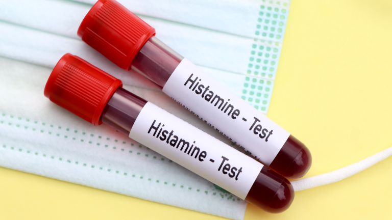 Histamin İntoleransı Testi