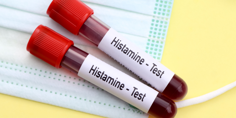 Histamin İntoleransı Testi