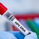 HPV Testi