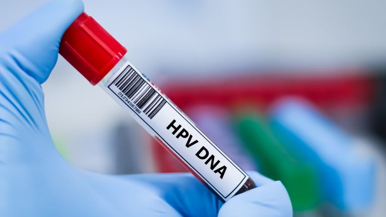 HPV Testi