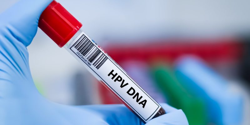 HPV Testi