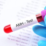 AMH Testi