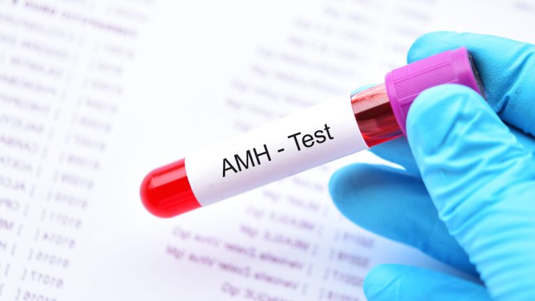 AMH Testi