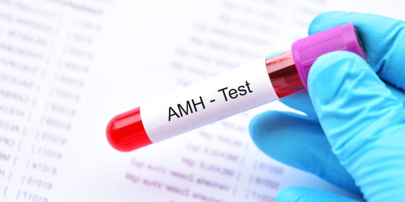 AMH Testi