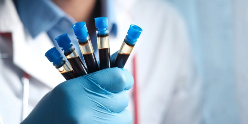 Cinsel Yolla Bulaşan Hastalıklar Testi