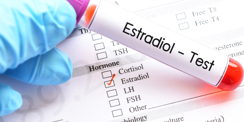 Estradiol (E2) Testi