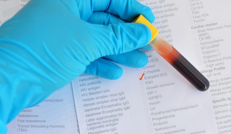 Estradiol (E2) Testi