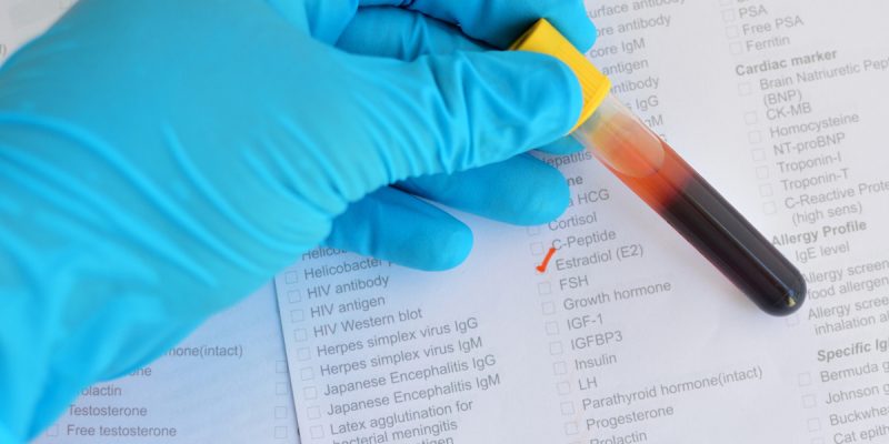 Estradiol (E2) Testi