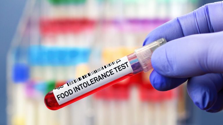 Gıda İntolerans Testi