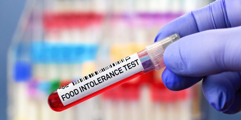 Gıda İntolerans Testi