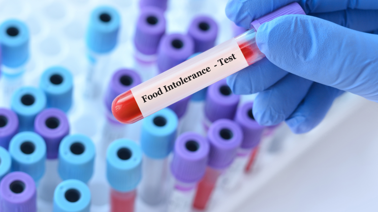 Gıda İntolerans Testi