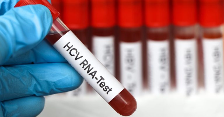 HCV RNA Testi
