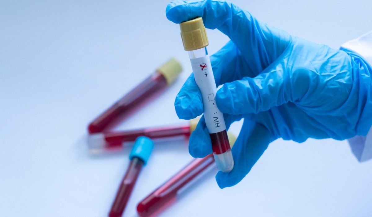 HIV Duo Ultra Testi HIV Duo Ultra Testi