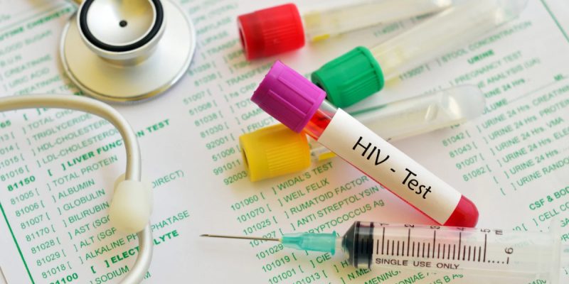 HIV Testi