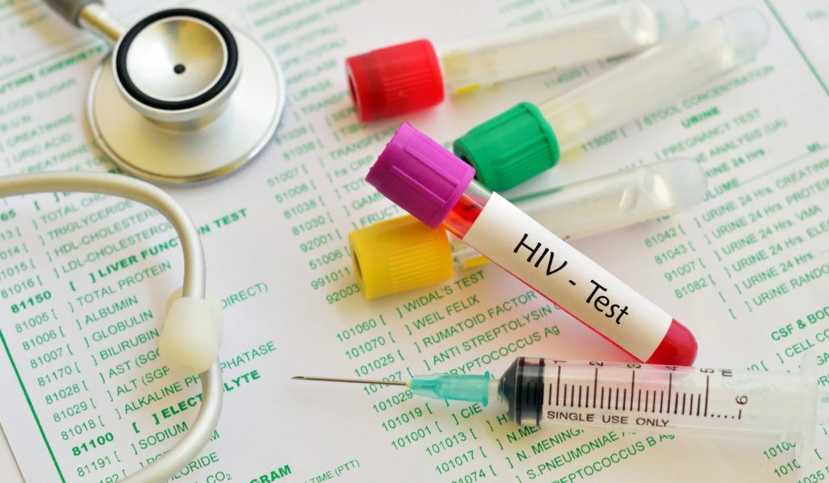 HIV Testi