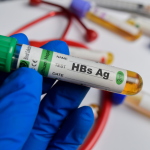 HbsAg Testi