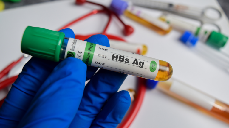 HbsAg Testi