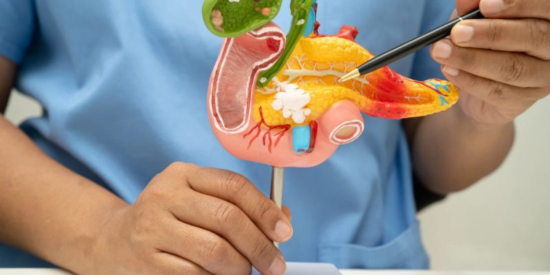 Pankreatik Fekal Elastaz Testi