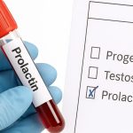 Prolaktin Testi