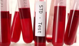 STD 10 PCR Testi