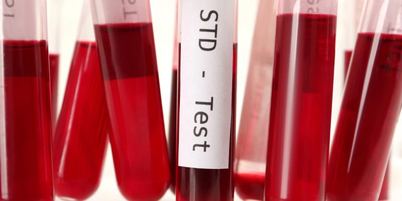 STD 10 PCR Testi