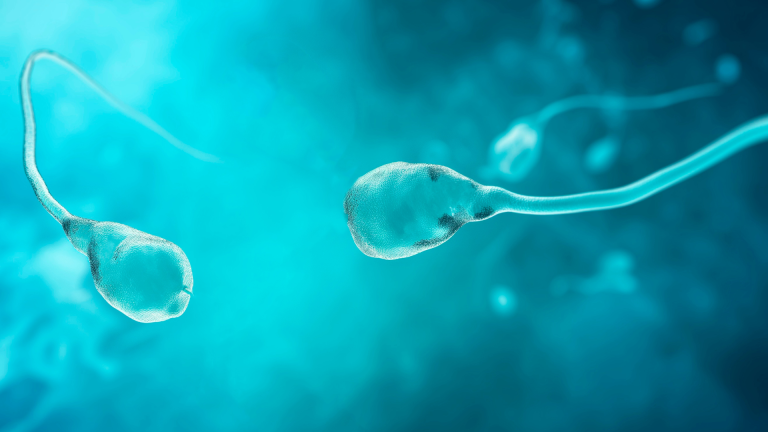 Sperm DNA Fragmantasyon Testi