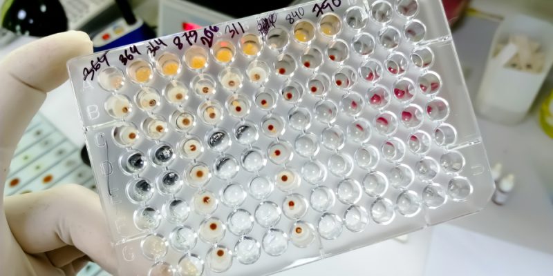 TPHA Testi Nedir?