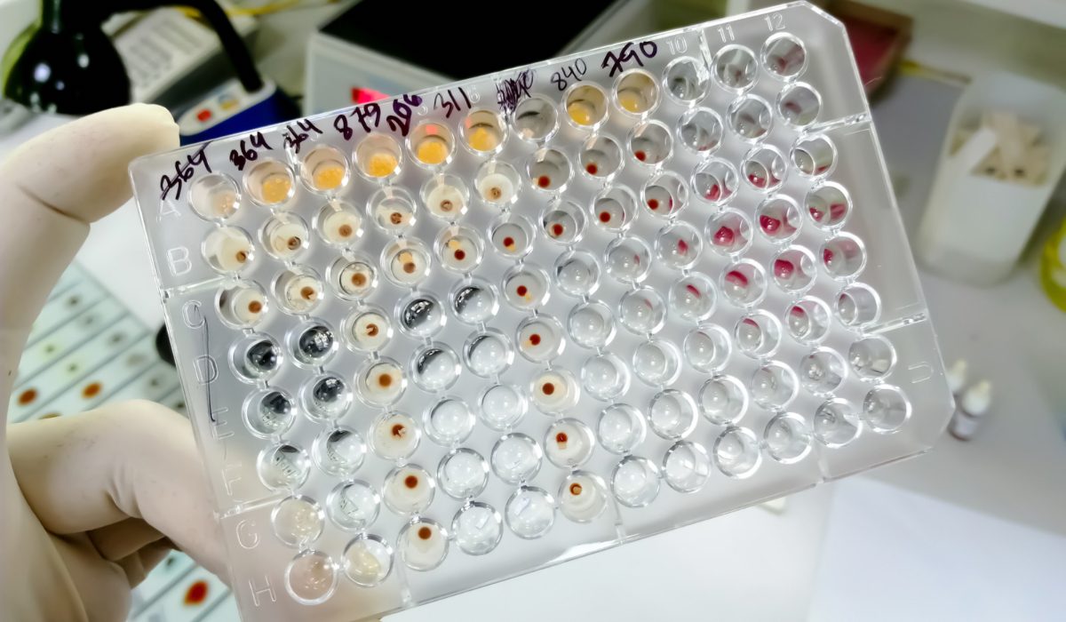 TPHA Testi Nedir?
