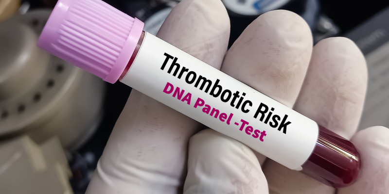Trombofili Paneli