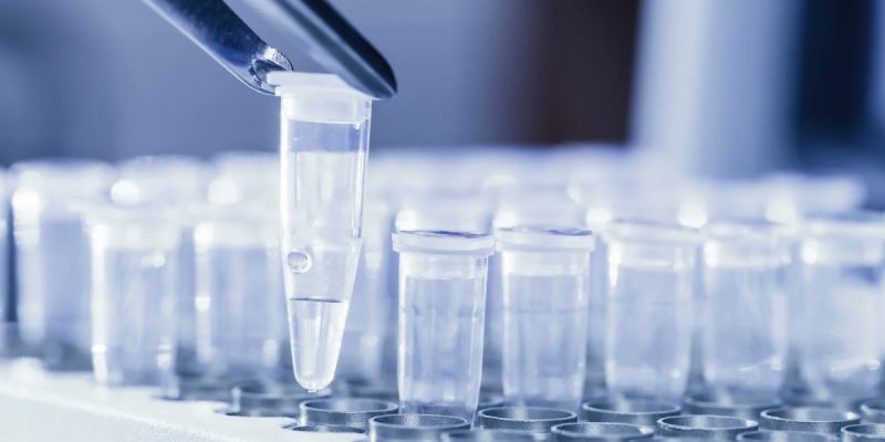 Ureaplasma Nedir?