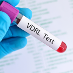VDRL Testi