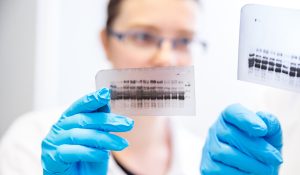 Western Blot Testi Nedir?
