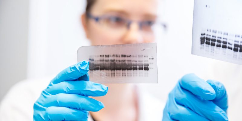 Western Blot Testi Nedir?