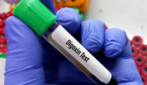 Digoksin Testi Nedir?