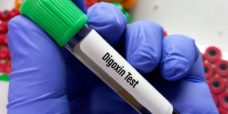Digoksin Testi Nedir?