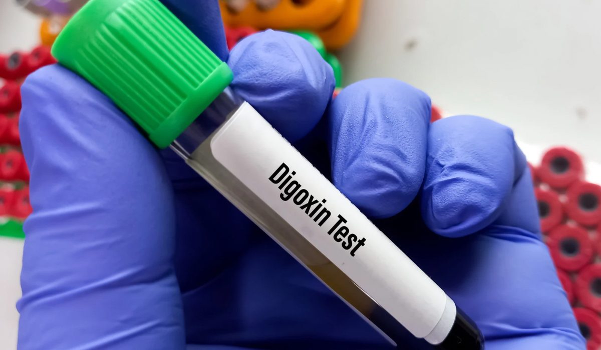 Digoksin Testi Nedir?