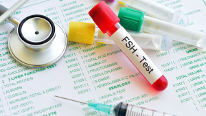 FSH Testi