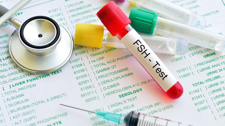 FSH Testi