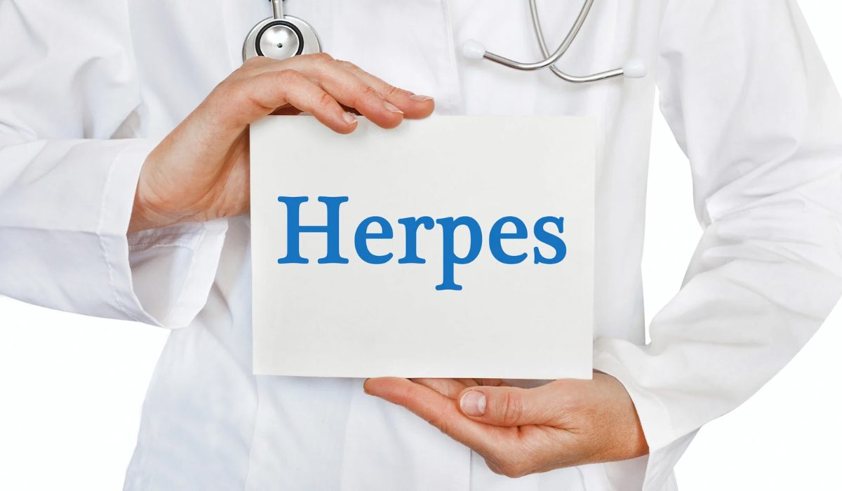 Herpes (HSV) Nedir?