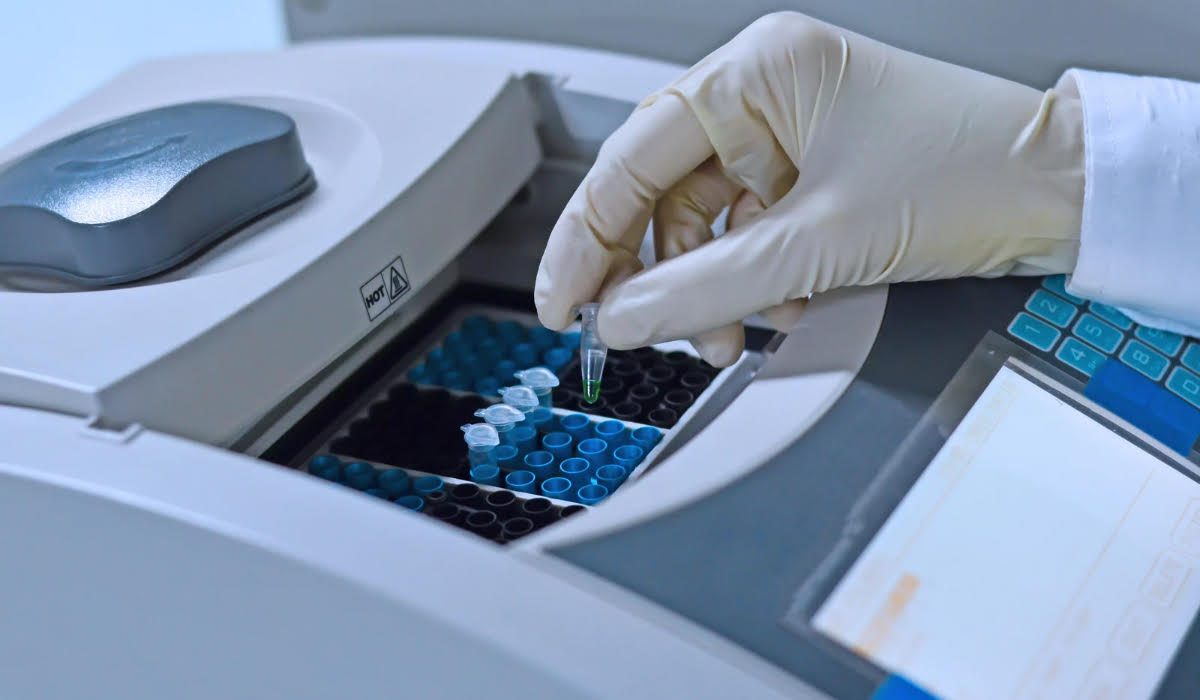 HIV PCR Testi HIV PCR Testi