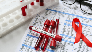 HIV Testi