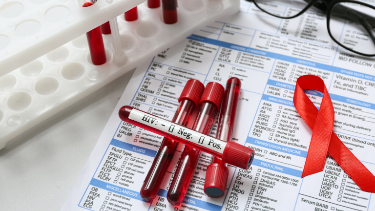 HIV Testi