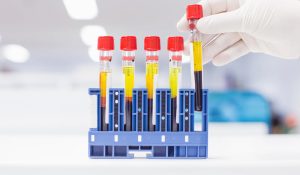 Kalp Krizi Testi