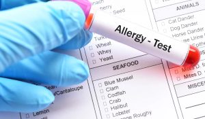 Moleküler Alerji Testi Nedir?