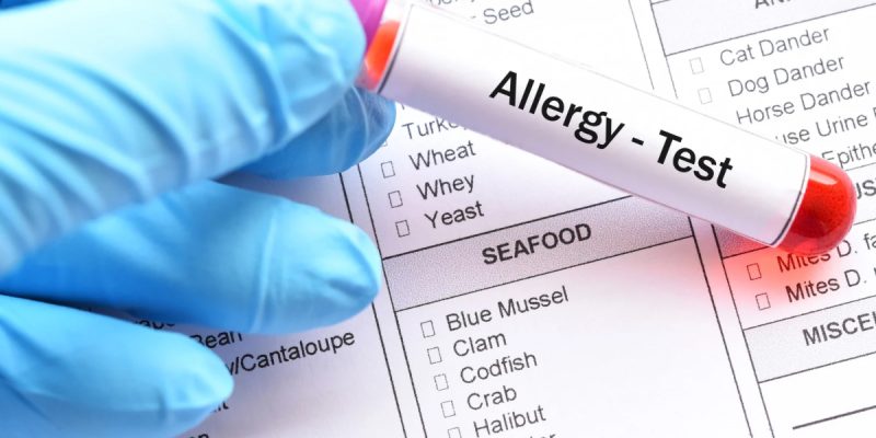 Moleküler Alerji Testi Nedir?