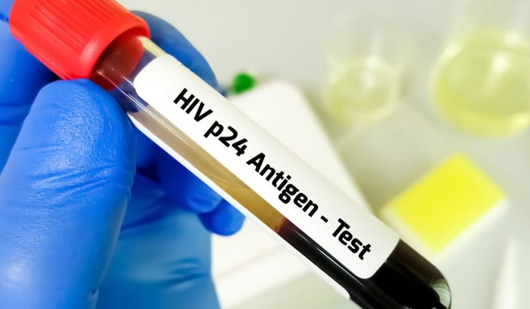p24 Antijen Testi