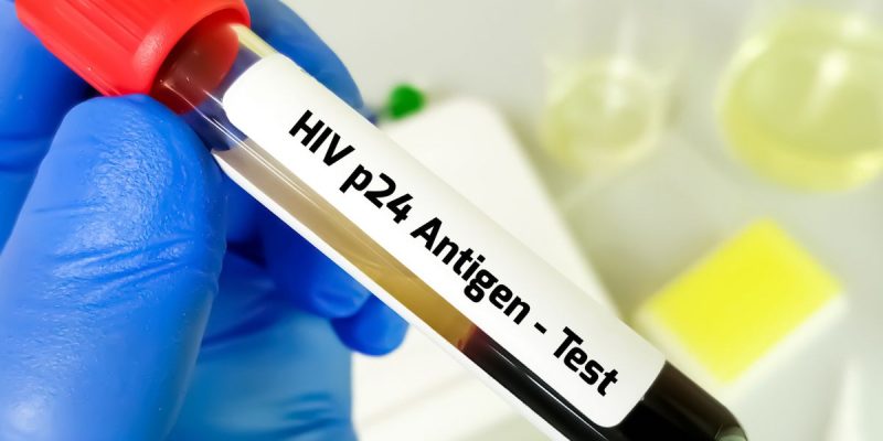 p24 Antijen Testi Nedir?