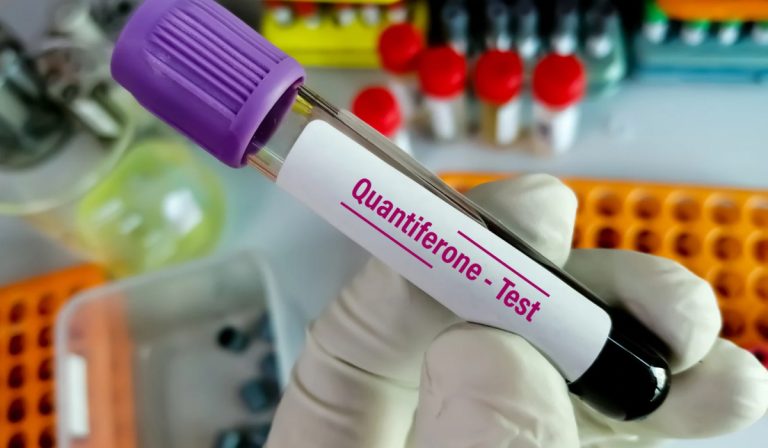 Quantiferon Testi