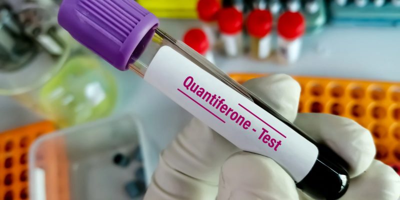 Quantiferon Testi
